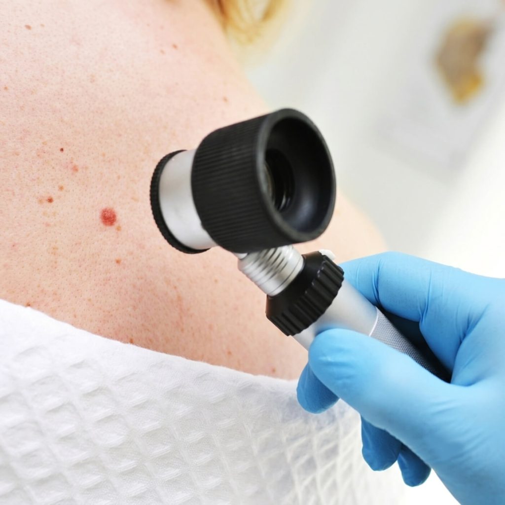 dermatoscopia-farmacia-sorbona